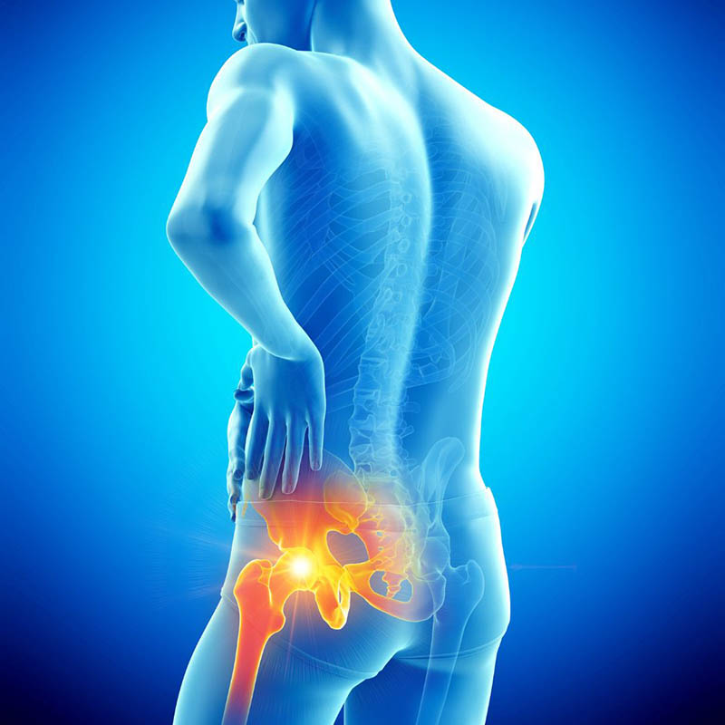 How I Treat My Own Hip Pain?